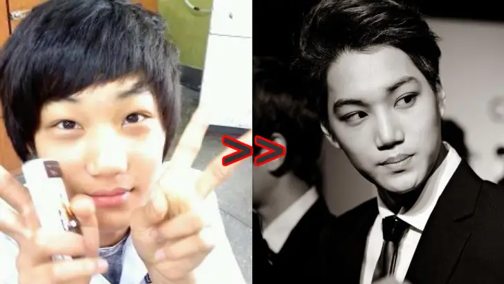 Kyuhyun Before And After Plastic Surgery