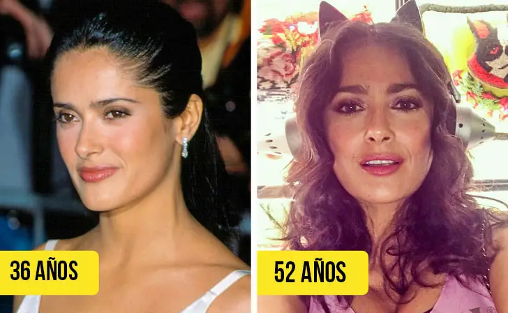 11 Fotos Del Antes Y Después De Famosas Que JamÁs Se Sometieron A Una 