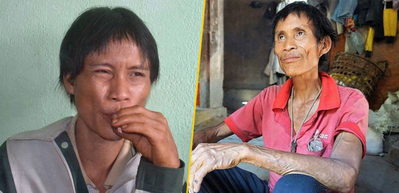 La historia de “Tarzán de la vida real” que sufrió de cáncer 8 años después de dejar la selva