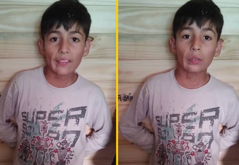 La historia del niño argentino que hornea pasteles para pagar su cirugía reconstructiva