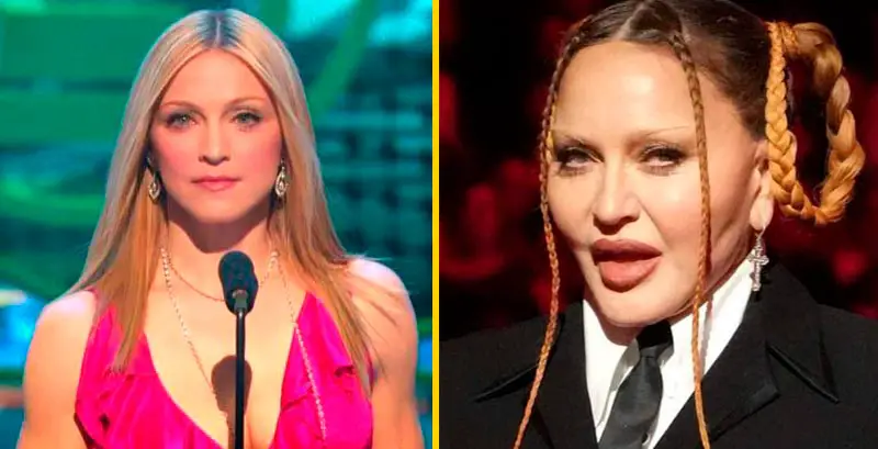 7 Polémicas que vivió Madonna tras mostrar su ‘nuevo rostro’ en los Grammys