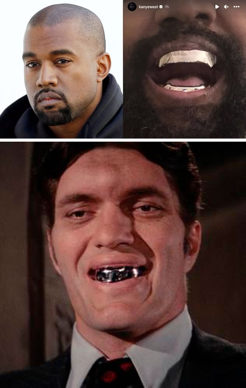 Kanye gasta un dineral en su nueva ‘dentadura’ y apenas puede hablar: 7 Detalles del caso