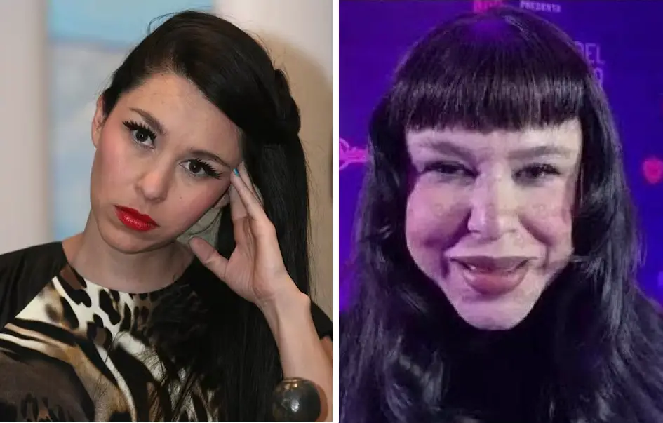 6 Detalles del ‘Drástico Cambio’ de la cantante Belanova que sacude X