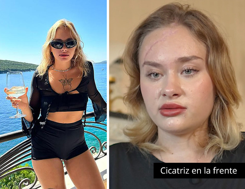 “Me fui de fiesta con ‘Chicos Rusos Millonarios’ y terminé paralítica”