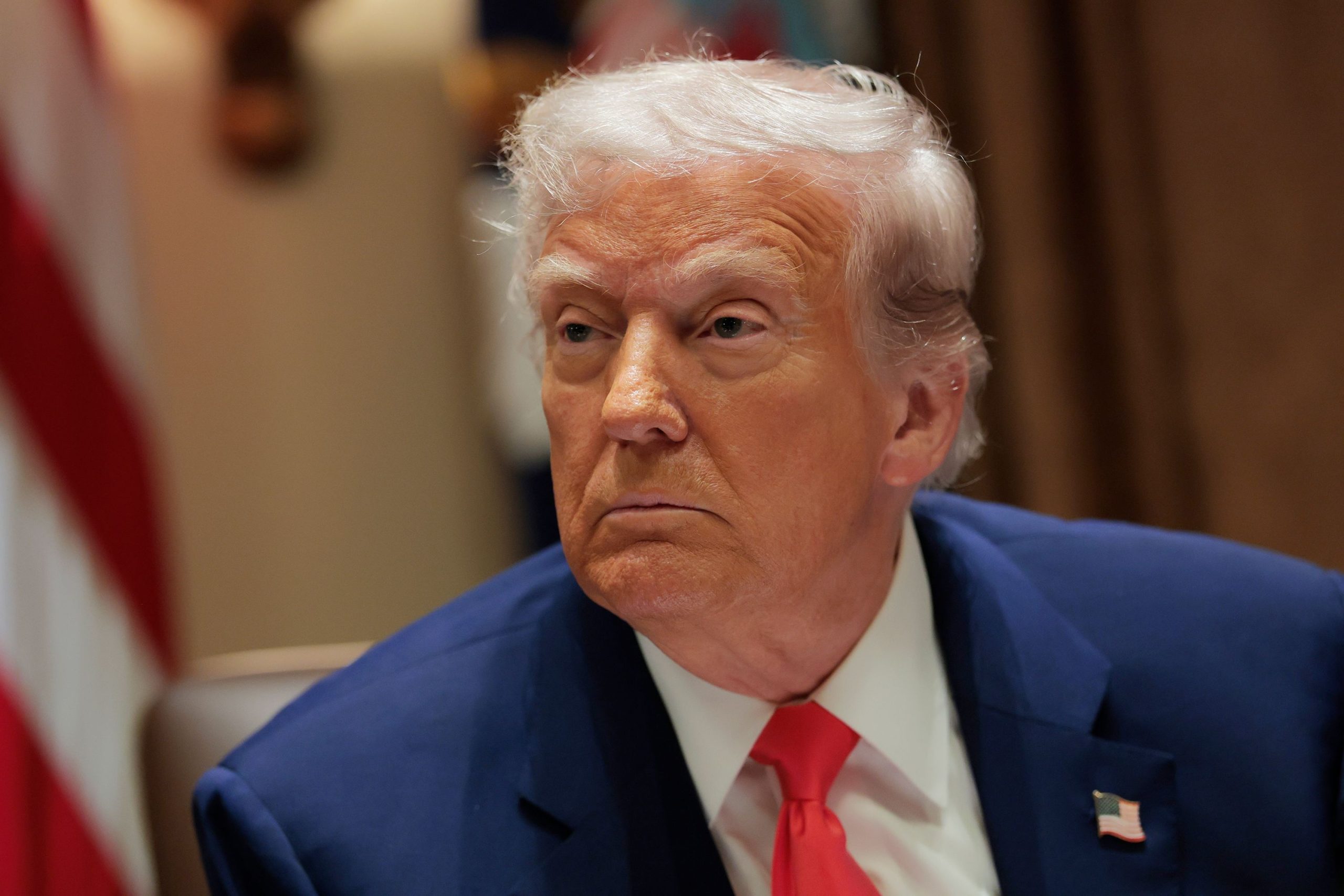 6 Datos de la ‘Enfermedad de Trump’: Insuficiencia Venosa Crónica