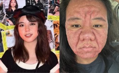 6 Datos del “Impacto Brutal” del embarazo en esta mujer malasia de 28 años