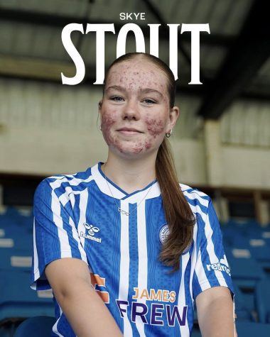 6 ‘Ataques Despiadados’ que sufrió la futbolista Skye Stout y el troll que lo inició todo