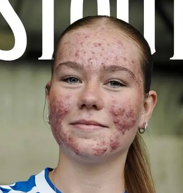 2. Se burlaron de su rostro