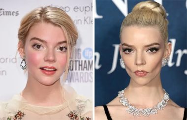 15 Actrices Famosas que ‘Cometieron el Error’ de hacerse una Bichectomía
