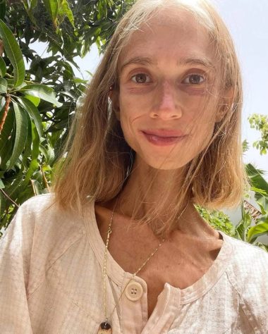 6 Datos del ‘Doloroso Final’ de la influencer que llevaba comiendo “solo fruta” por 8 años