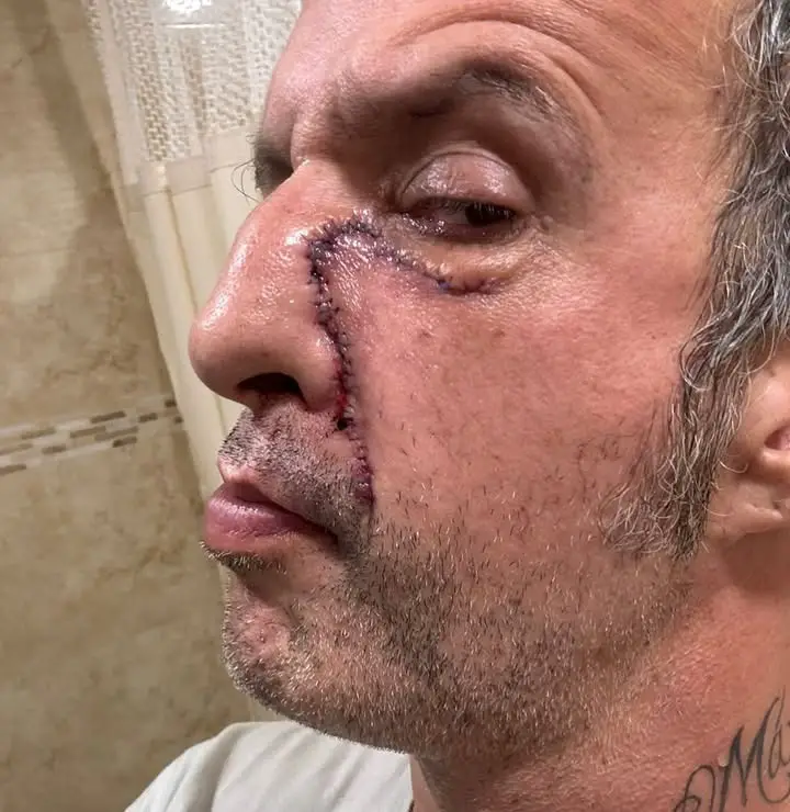1. Todo comenzó con una foto impactante de Tito