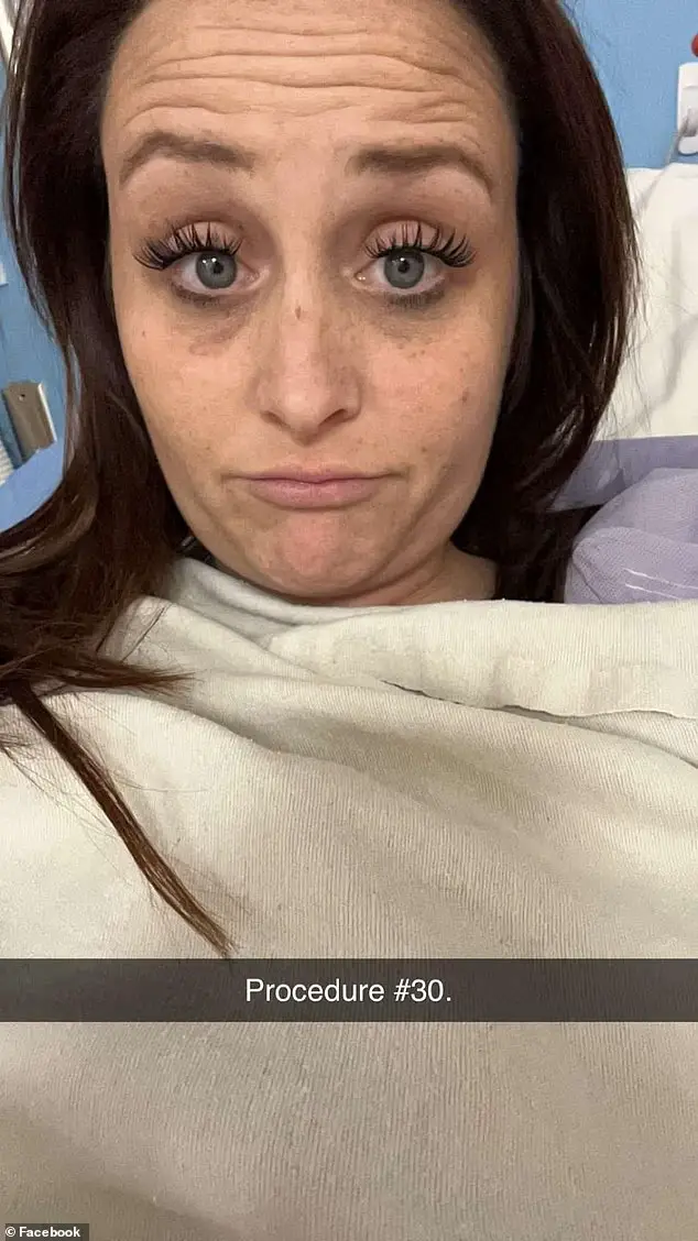 3. Pasó dos años sufriendo quemaduras químicas