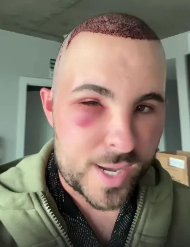 4. Luego se le inflamó el rostro