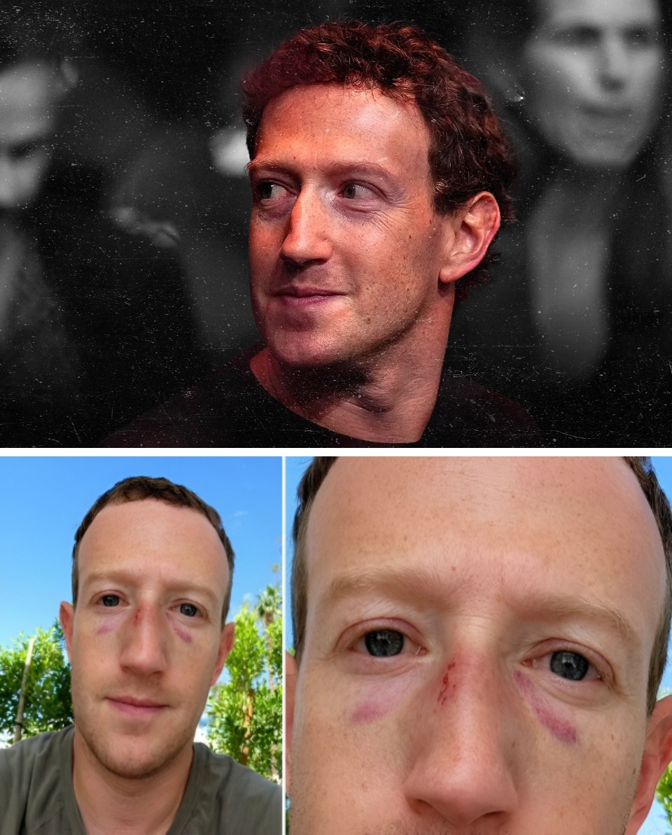 5. Zuckerberg se rompió la nariz entrenando
