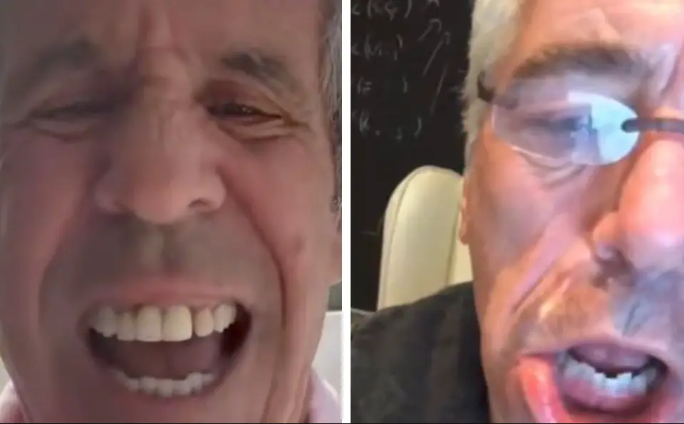 4. Algunos compararon su dentadura