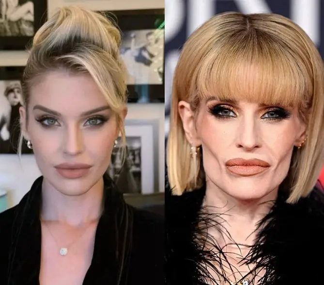 4. Niega estar tomando Ozempic